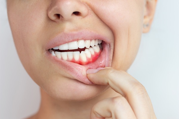 How Does A Dentist Approach Gum Disease Treatment?
